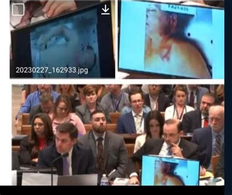 leaked autopsy photos|Alex Murdaugh trial: Autopsy photos shown, and witnesses paint。